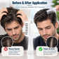 Scalp Massage And Relaxing Comb With Rolling Balls For Scalp Relaxation And Hair Care